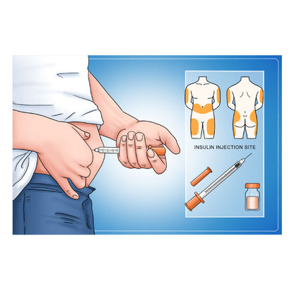 Premium Ultra-Fine Insulin Peptide Pen Needles 32G (0.23 x 4mm) - Sterile Disposable (100 Count x 1 Pack)